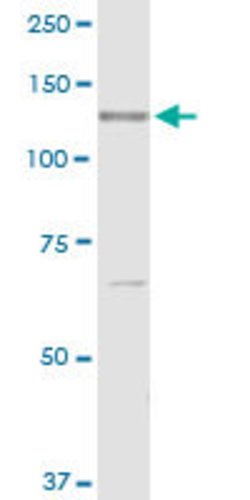 RECK, Rabbit anti-Human, Polyclonal Antibody, Abnova 100&mu;g; Unconjugated:Antibodies,