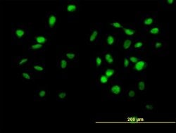 CUL4B, Mouse anti-Human, Polyclonal Antibody, Abnova 50&mu;L; Unconjugated:Antibodies,