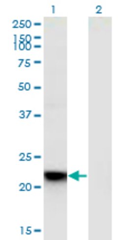 RGS5, Mouse anti-Human, Clone: 4E12, Abnova 100 &mu;g | Buy Online | Abnova | Fisher Scientific