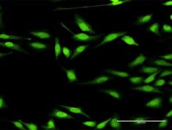 DGKZ, Rabbit anti-Human, Polyclonal Antibody, Abnova 100&mu;L; Unconjugated:Antibodies,