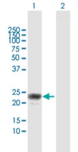 APOL1, Rabbit anti-Human, Polyclonal Antibody, Abnova 100&mu;L; Unconjugated:Antibodies,
