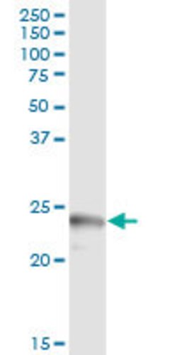 APOL1, Rabbit anti-Human, Polyclonal Antibody, Abnova 100&mu;L; Unconjugated:Antibodies,