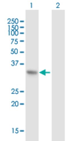 PIR, Mouse anti-Human, Polyclonal Antibody, Abnova 50&mu;g; Unconjugated:Antibodies,