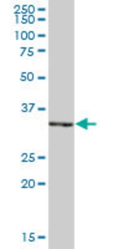 PIR, Mouse anti-Human, Polyclonal Antibody, Abnova 50&mu;g; Unconjugated:Antibodies,