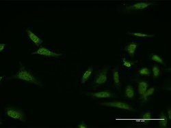 MKNK1, Mouse anti-Human, Clone: 2E5, Abnova 50 &mu;g | Buy Online | Abnova | Fisher Scientific