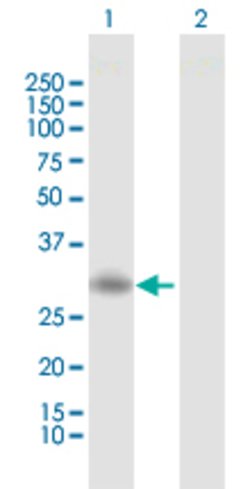 RGS20, Rabbit anti-Human, Polyclonal Antibody, Abnova 100&mu;L; Unconjugated:Antibodies,