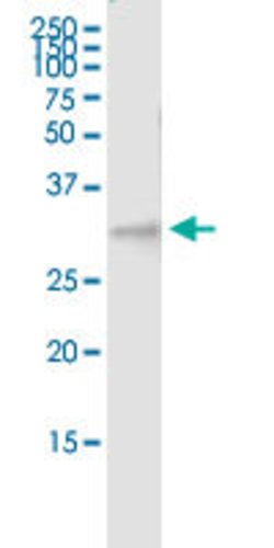 RGS20, Rabbit anti-Human, Polyclonal Antibody, Abnova 100&mu;L; Unconjugated:Antibodies,