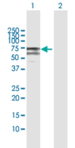 ASMTL, Rabbit anti-Human, Polyclonal Antibody, Abnova 100&mu;L; Unconjugated:Antibodies,