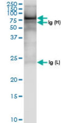ASMTL, Rabbit anti-Human, Polyclonal Antibody, Abnova 100&mu;L; Unconjugated:Antibodies,