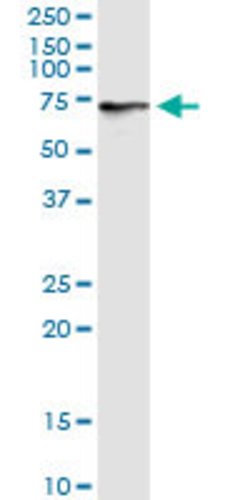 ASMTL, Rabbit anti-Human, Polyclonal Antibody, Abnova 100&mu;g; Unconjugated:Antibodies,