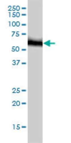 RNMT, Mouse anti-Human, Clone: 3H3-1D12, Abnova 100&mu;g; Unconjugated:Antibodies,