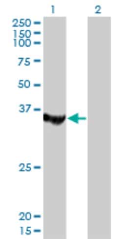 MTMR1, Mouse anti-Human, Clone: 1F10, Abnova 100&mu;g; Unconjugated:Antibodies,