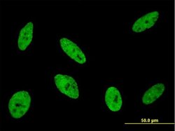 CDKL1, Mouse anti-Human, Clone: 5B11, Abnova 100&mu;g; Unconjugated:Antibodies,