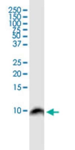 BANF1, Mouse anti-Human, Clone: M2, Abnova 100&mu;g; Unconjugated:Antibodies,
