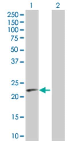 PGLYRP1, Rabbit anti-Human, Polyclonal Antibody, Abnova 100&mu;g; Unconjugated:Antibodies,