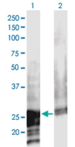 NOL3, Mouse anti-Human, Clone: 3A9, Abnova 100&mu;g; Unconjugated:Antibodies,