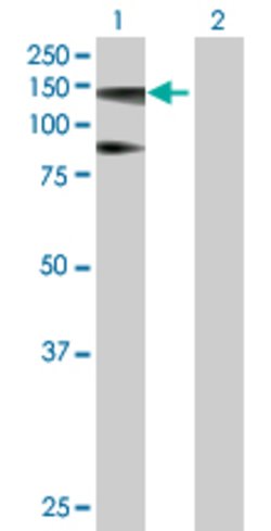 HIP1R, Mouse anti-Human, Polyclonal Antibody, Abnova 50&mu;g; Unconjugated:Antibodies,
