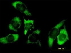 USP10, Mouse anti-Human, Polyclonal Antibody, Abnova 50&mu;g; Unconjugated:Antibodies,