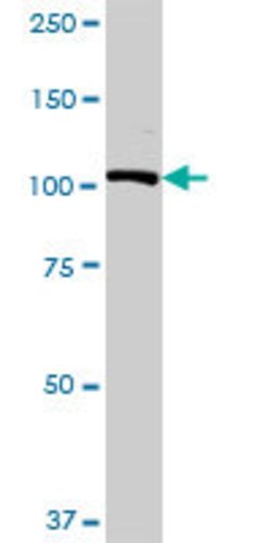 USP10, Rabbit anti-Human, Polyclonal Antibody, Abnova 100&mu;L; Unconjugated:Antibodies,