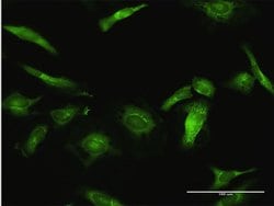 USP10, Rabbit anti-Human, Polyclonal Antibody, Abnova 100&mu;L; Unconjugated:Antibodies,