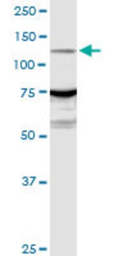 ARHGEF1, Rabbit anti-Human, Polyclonal Antibody, Abnova 100&mu;g; Unconjugated:Antibodies,