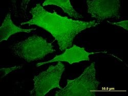 MAP3K13, Mouse anti-Human, Clone: 4H7, Abnova 100&mu;g; Unconjugated:Antibodies,