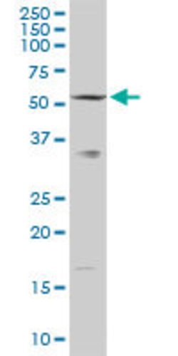 SLC33A1, Rabbit anti-Human, Polyclonal Antibody, Abnova 100&mu;g; Unconjugated:Antibodies,