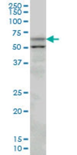 SLC33A1, Mouse anti-Human, Clone: 3A4, Abnova 100&mu;g; Unconjugated:Anticorps,