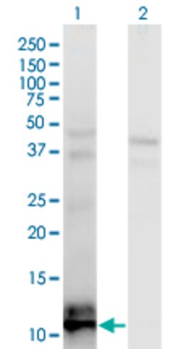 TIAF1, Mouse anti-Human, Clone: 3B9, Abnova 100 &mu;g | Buy Online | Abnova | Fisher Scientific