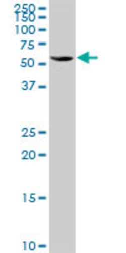TBRG4, Mouse anti-Human, Polyclonal Antibody, Abnova 50&mu;g; Unconjugated:Antibodies,