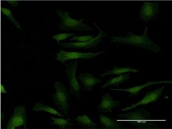 MAPKAPK2, Mouse anti-Human, Clone: 1F9, Abnova 100&mu;g; Unconjugated:Antibodies,