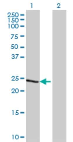 TCEAL1, Mouse anti-Human, Clone: 2B5, Abnova 100&mu;g; Unconjugated:Antibodies,