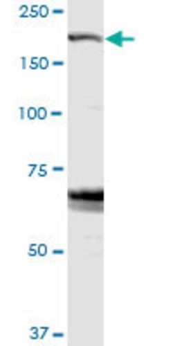 ZFYVE9, Rabbit anti-Human, Polyclonal Antibody, Abnova 100&mu;L; Unconjugated:Antibodies,