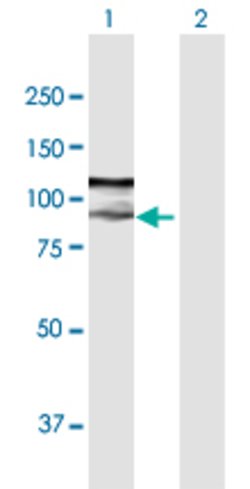 ZFYVE9, Rabbit anti-Human, Polyclonal Antibody, Abnova 100&mu;L; Unconjugated:Antibodies,