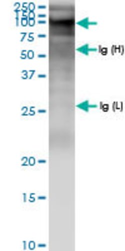 ZFYVE9, Rabbit anti-Human, Polyclonal Antibody, Abnova 100&mu;L; Unconjugated:Antibodies,