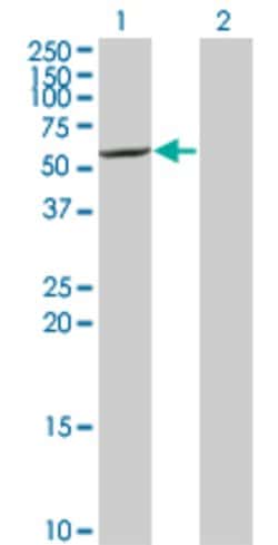 CYP7B1, Mouse anti-Human, Clone: 2B11, Abnova 100&mu;g; Unconjugated:Antibodies,