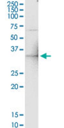 GGPS1, Rabbit anti-Human, Polyclonal Antibody, Abnova 100&mu;L; Unconjugated:Antibodies,