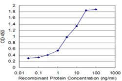ARHGEF6, Mouse anti-Human, Clone: 2E5, Abnova 100&mu;g; Unconjugated:Anticuerpos