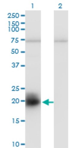 HAND2, Mouse anti-Human, Clone: 1C7, Abnova 100&mu;g; Unconjugated:Antibodies,