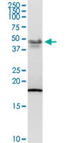 PCYT1B, Rabbit anti-Human, Polyclonal Antibody, Abnova 100&mu;g; Unconjugated:Antibodies,