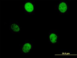 KIF23, Mouse anti-Human, Polyclonal Antibody, Abnova 50&mu;g; Unconjugated:Antibodies,