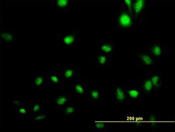 CREB5, Mouse anti-Human, Polyclonal Antibody, Abnova 50&mu;g; Unconjugated:Antibodies,