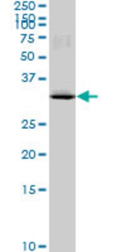 MAD2L1BP, Mouse anti-Human, Clone: 4G11, Abnova 100&mu;g; Unconjugated:Antibodies,
