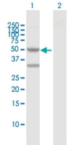 PPM1F, Rabbit anti-Human, Polyclonal Antibody, Abnova 100&mu;L; Unconjugated:Antibodies,