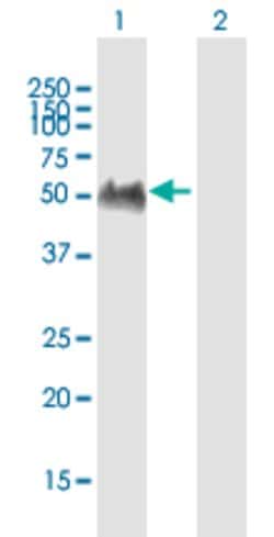 GPRIN2, Mouse anti-Human, Polyclonal Antibody, Abnova 50 &mu;g | Buy Online | Abnova | Fisher Scientific