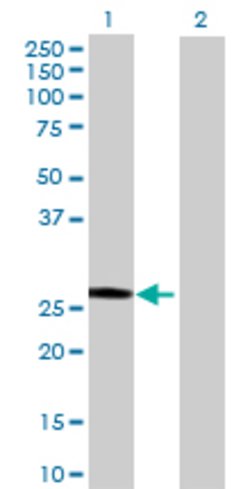 SART3, Mouse anti-Human, Polyclonal Antibody, Abnova 50&mu;L; Unconjugated:Antibodies,