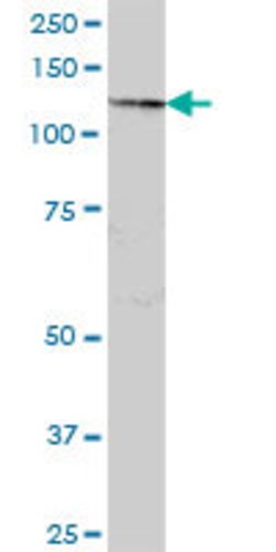 SART3, Mouse anti-Human, Polyclonal Antibody, Abnova 50&mu;L; Unconjugated:Antibodies,