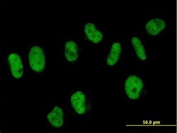SART3, Mouse anti-Human, Polyclonal Antibody, Abnova 50&mu;L; Unconjugated:Antibodies,