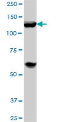 HDAC4, Mouse anti-Human, Clone: 2B11, Abnova 100&mu;g; Unconjugated:Antibodies,