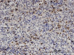 HDAC4, Mouse anti-Human, Clone: 2B11, Abnova 100&mu;g; Unconjugated:Antibodies,